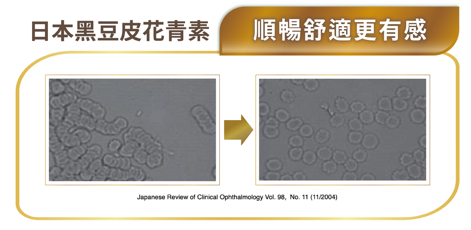 添加日本黑豆皮花青素，桂格康研家葉黃素膠囊（原天地合補EXX葉黃素膠囊）升級版，攝取後血管順暢舒適